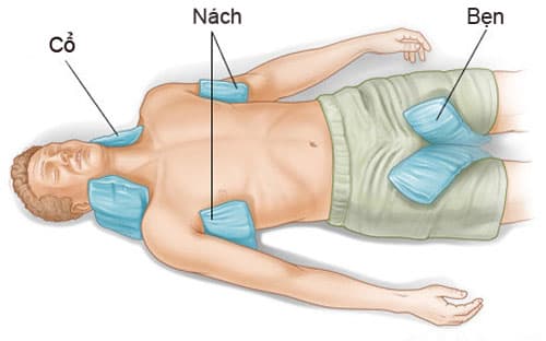 Xử trí khi có người say nắng ngất xỉu